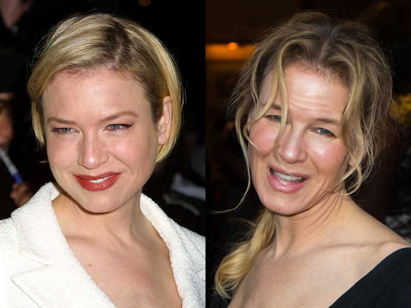 renee zellweger