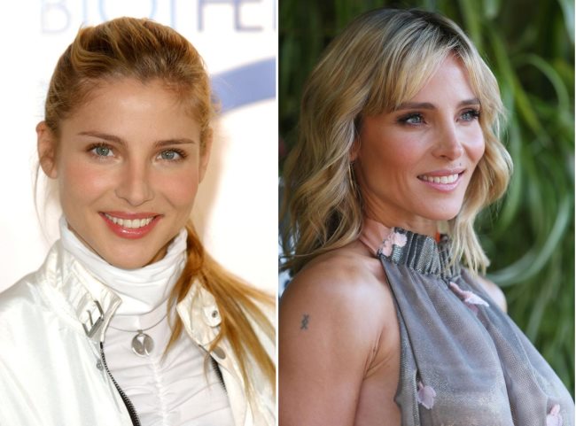 Elsa Pataky rhinoplastie