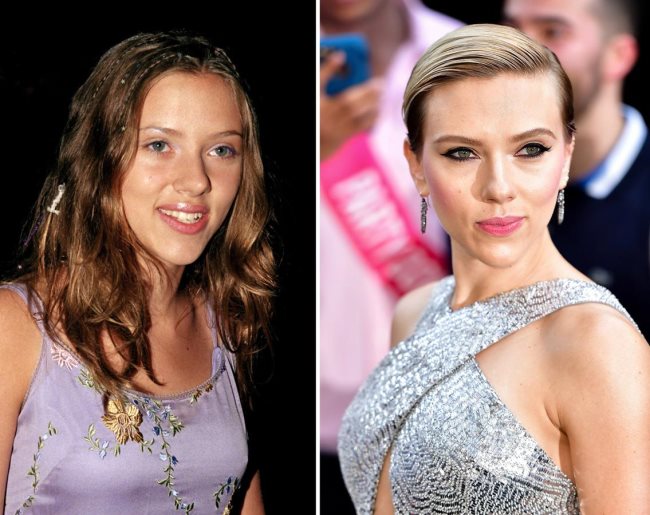 Scarlett Johansson rhinoplastie