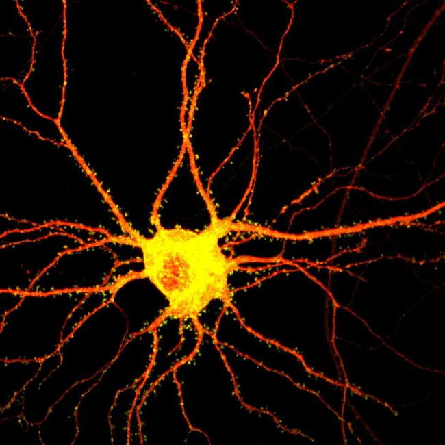 Quelles sont les parties d'un neurone ?