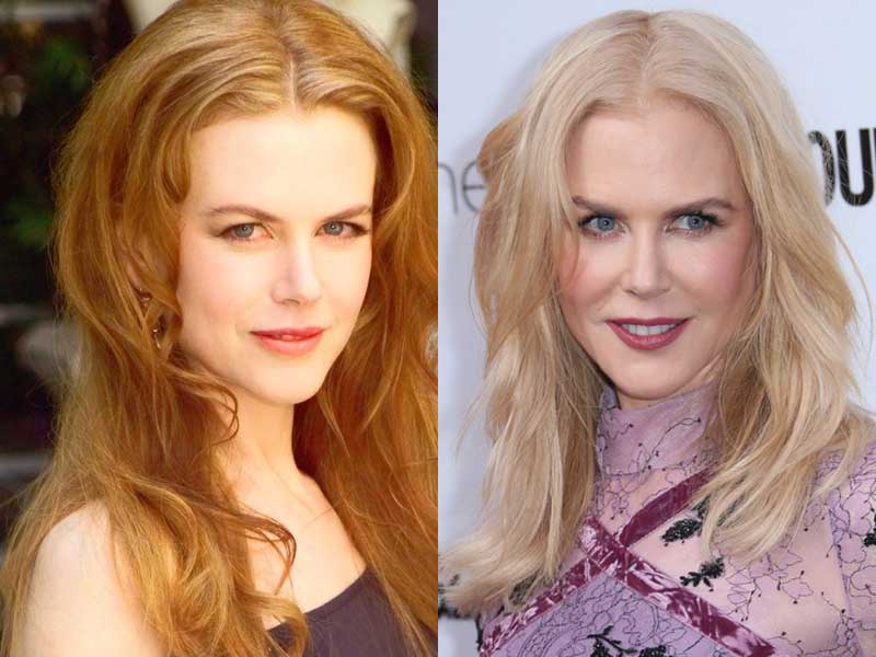 nicole kidman