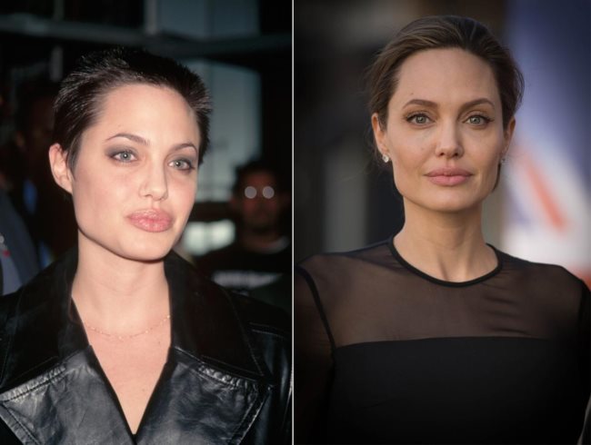 Angelina Jolie rinoplastica